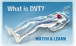 What is DVT?